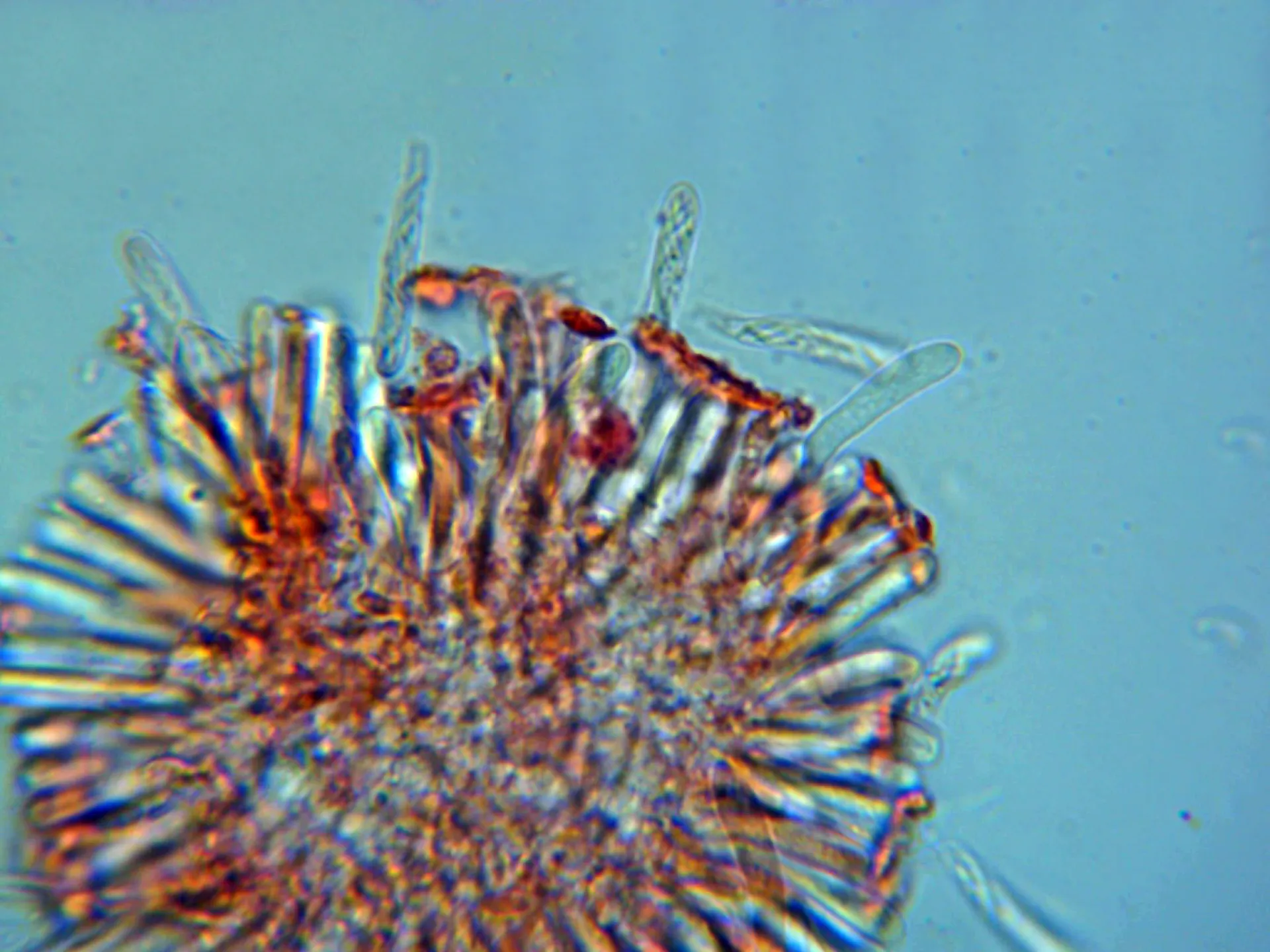 Microscopía de Orbilia crenatomarginata - 10 - Ascas x 1000